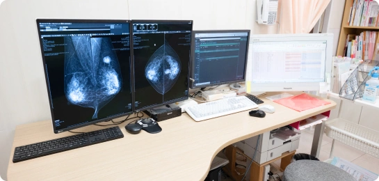 マンモグラフィ検査