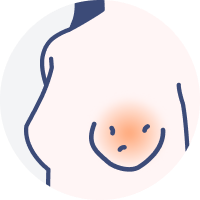 皮膚がオレンジの皮のようになる